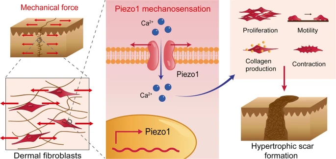 机械拉伸通过机械激活的阳离子通道 Piezo1 促进增生性瘢痕形成