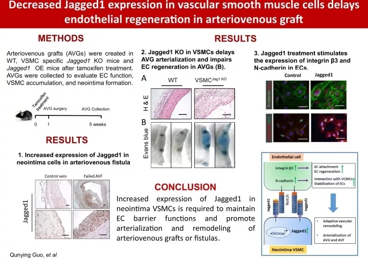 血管平滑肌细胞中 Jagged1 表达的降低延迟了动静脉移植物中的内皮细胞再生