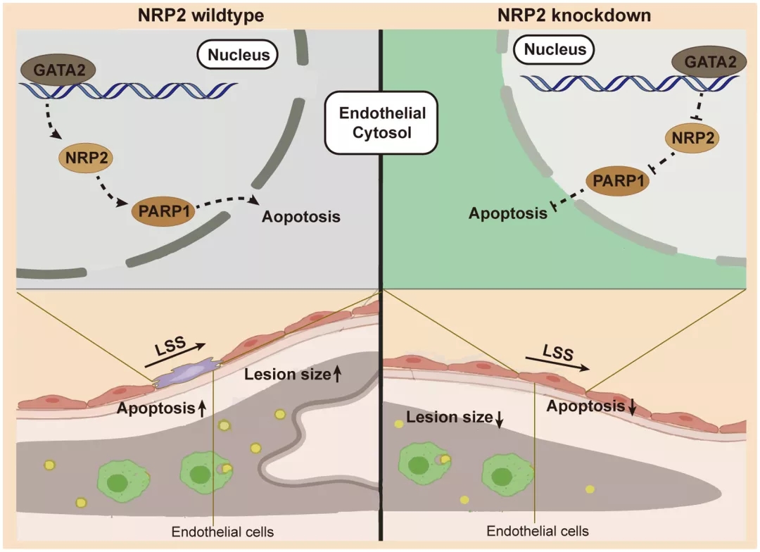 NRP2 通过上调 PARP1 表达和增强 LSS 诱导的内皮细胞凋亡促进动脉粥样硬化