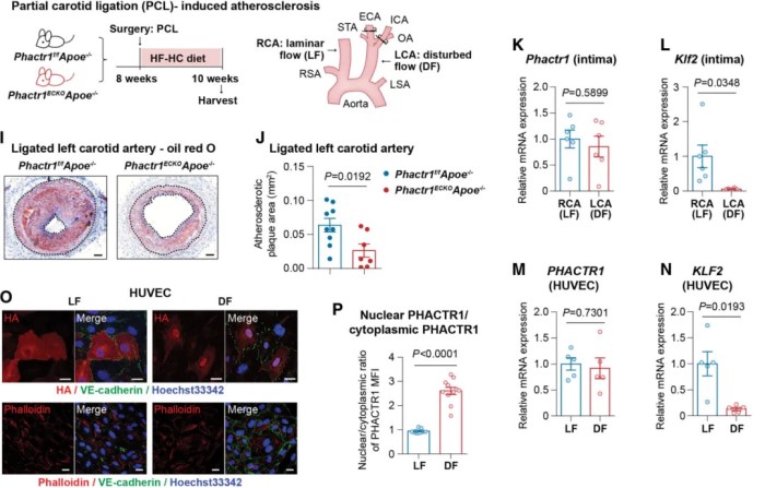 内皮 PHACTR1 通过抑制小鼠血流紊乱下的 PPARγ 活性来促进内皮细胞活化和动脉粥样硬化