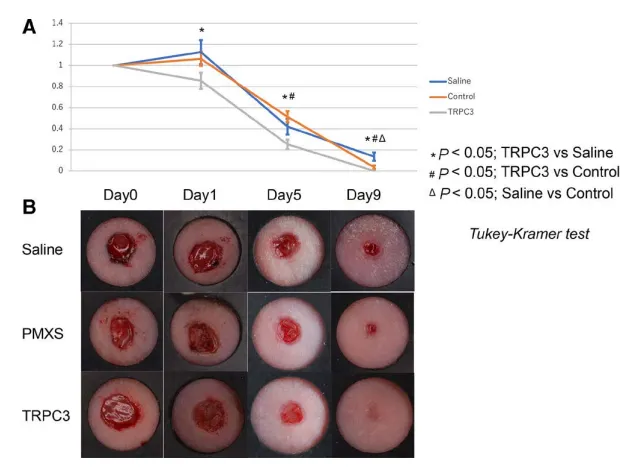 拉伸通过增强成纤维细胞中内皮素受体B和TRPC3 的表达来促进伤口收缩