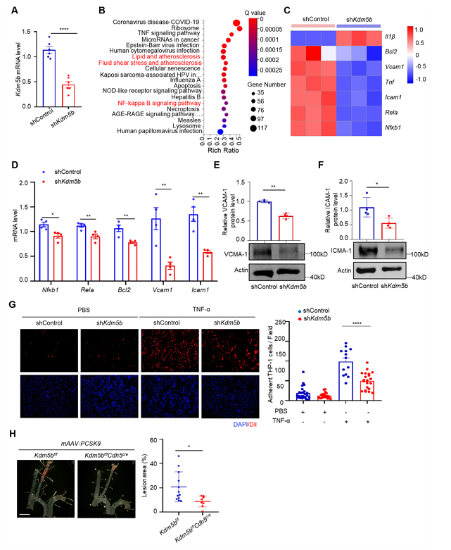 Piezo1 调控的内皮 KDM5B 参与紊乱血流诱导的动脉粥样硬化斑块形成