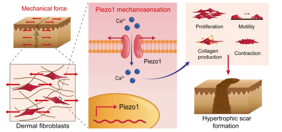 机械牵张通过机械激活的阳离子通道 Piezo1 促进增生性瘢痕的形成