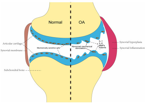 机械信号转导：流体剪切力在骨关节炎发展中的关键作用