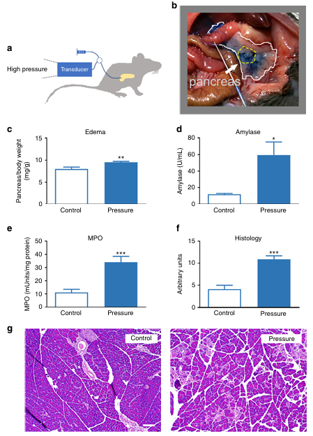 Piezo1是一种介导压力诱导胰腺炎的机械激活离子通道
