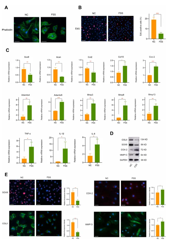 异常流体剪切应力通过 H3K4me3 对 ZBTB20 的表观遗传调控促进关节软骨发病机制